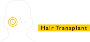 Nutrite Hair Transplant